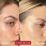 ELIX’SCIENCE – 10 GR COLLAGÈNE MARIN D’EAU DOUCE + ANTIOXYDANTS